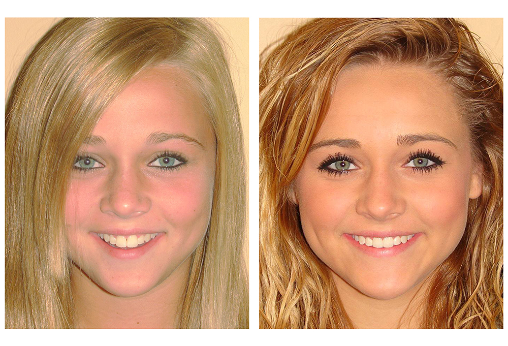 Santa Fe Family Dental