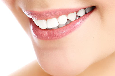 A close-up of a person's smiling face, showcasing teeth whitening results.