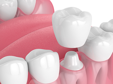 Santa Fe Family Dental